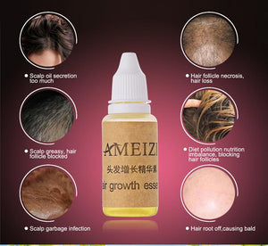 Ameizii Hair Growth Essence Oil
